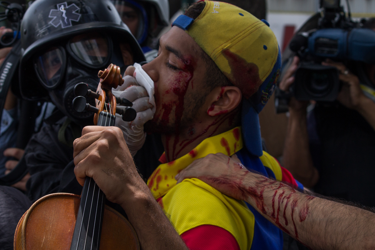 El joven violinista Wuilly Arteaga fue herido con perdigones durante las manifestaciones contra el gobierno de Nicolás Maduro | Foto: Iván Reyes